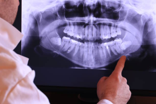 Best Tooth Infection Emergency Dentist  in Gateway, FL